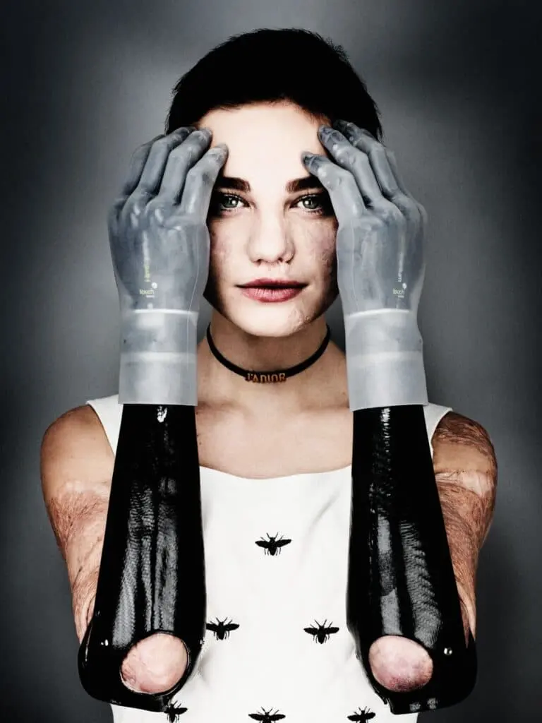 Bebe vio di giovanni gastel Bebe Vio di Giovanni Gastel